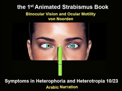 馬篤氏鏡原理|Motor Signs in Heterophoria and Heterotropia